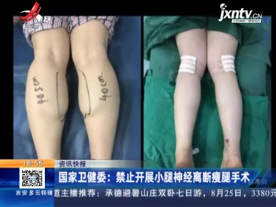 国家卫健委：禁止开展小腿神经离断瘦腿手术