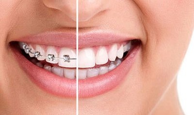 运动健身、牙齿矫正……颜值消费成暑期经济新热点