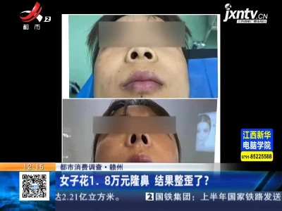 【都市消费调查】赣州：女子花1.8万元隆鼻 结果整歪了？