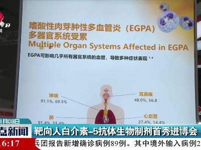 靶向人白介素-5抗体生物制剂首秀进博会