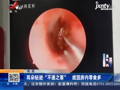 南昌：耳朵钻进“不速之客” 或因房内零食多