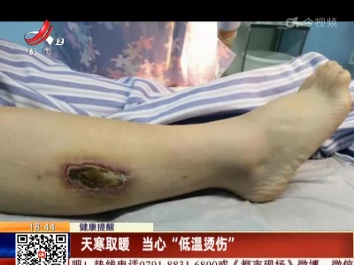 【健康提醒】天寒取暖 当心“低温烫伤