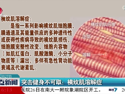 突击健身不可取：横纹肌溶解症