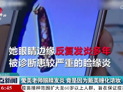 爱美老师眼睛发炎 竟是因为戴美瞳化浓妆