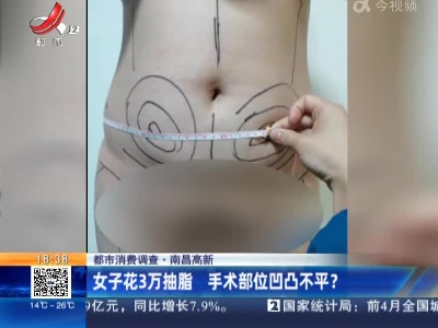 【都市消费调查】南昌高新：女子花3万抽脂 手术部位凹凸不平？