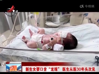 新生女婴口含“龙珠” 医生从医30年头次见