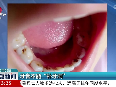 牙膏不能“补牙洞”