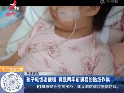 陕西西安：孩子吃饭老被噎 竟是两年前误吞的贴纸作祟