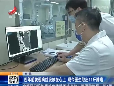 南昌：四年前发现病灶没放在心上 现今医生取出11斤肿瘤