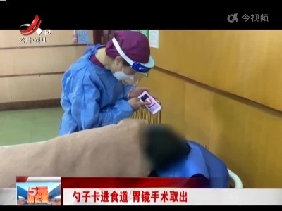勺子卡进食道 胃镜手术取出