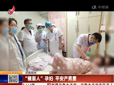 河南郑州：“镜面人”孕妇 平安产男婴