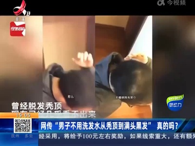 网传“男子不用洗发水从秃顶到满头黑发”真的吗？