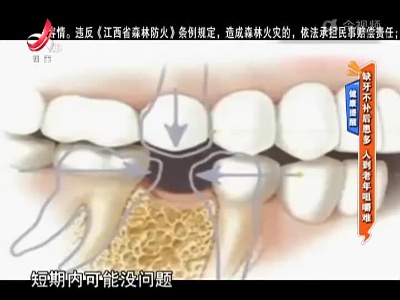健康提醒——缺牙不补后患多 人到老年咀嚼难