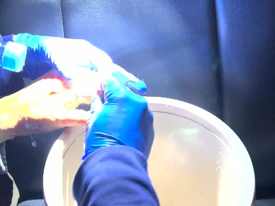 江西赣州：宁都大队消防员巧剪“咬手”戒指