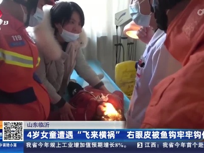 山东临沂：4岁女童遭遇“飞来横祸” 右眼皮被鱼钩牢牢钩住