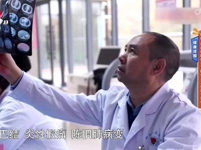 健康提醒——“阳康”后出现肺结节 ？医生：不要过于害怕！