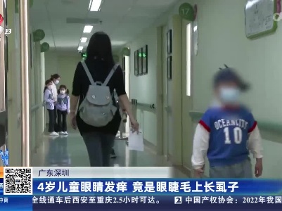 广东深圳：4岁儿童眼睛发痒 竟是眼睫毛上长虱子