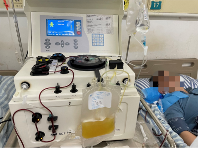 南昌市第一医院神经内科成功开展血浆置换术
