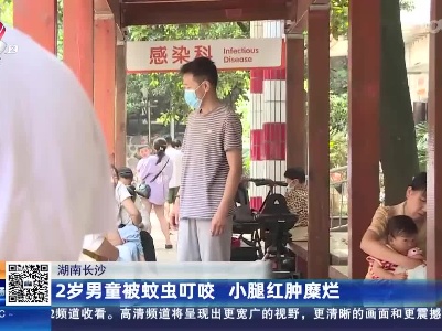 湖南长沙：2岁男童被蚊虫叮咬 小腿红肿糜烂