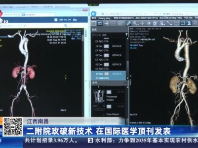 江西南昌：二附院攻破新技术 在国际医学顶刊发表