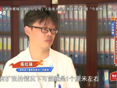 【安全提醒】男婴误食“水宝宝” 警惕危险的“玩具”