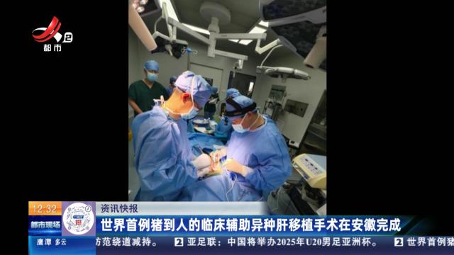 世界首例猪到人的临床辅助异种肝移植手术在安徽完成