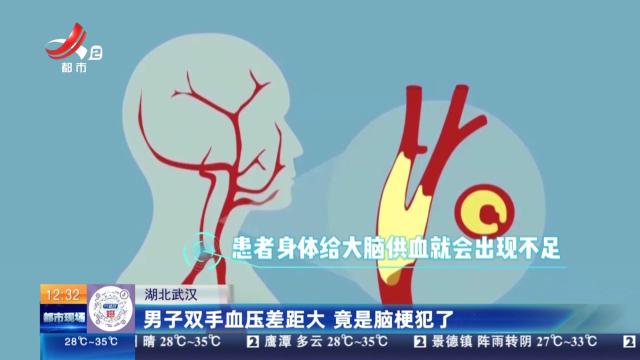 湖北武汉：男子双手血压差距大 竟是脑梗犯了