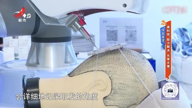 今日关注——“黑科技”助力解决“头等大事”
