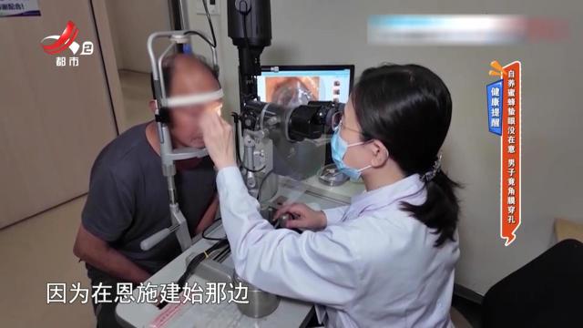 健康提醒——自养蜜蜂蜇眼没在意 男子竟角膜穿孔