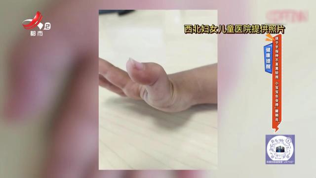 健康提醒——孩子手指伸不直莫轻视 小宝宝也会得“腱鞘炎”