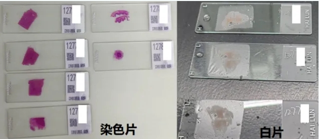 江西省儿童医院病理切片的借与还