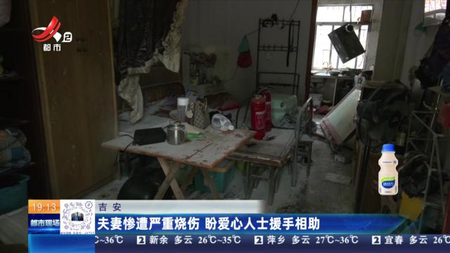 吉安：夫妻惨遭严重烧伤 盼爱心人士援手相助