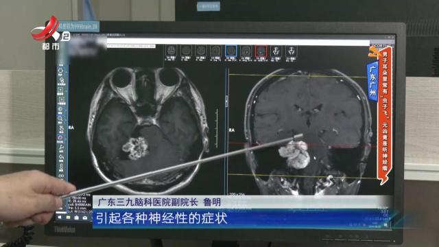 广东广州——男子耳朵里常有“虫子” 元凶竟是听神经瘤