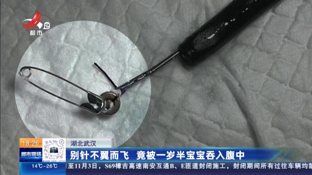 湖北武汉：别针不翼而飞 竟被一岁半宝宝吞入腹中