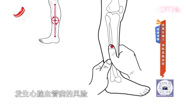 健康提醒：按揉丰隆穴 预防高脂血症