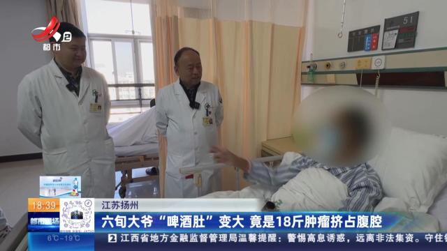 江苏扬州：六旬大爷“啤酒肚”变大 竟是18斤肿瘤挤占腹腔