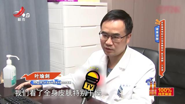 健康提醒——皮肤瘙痒难耐还出现鱼鳞裂纹 医生提醒：少洗澡
