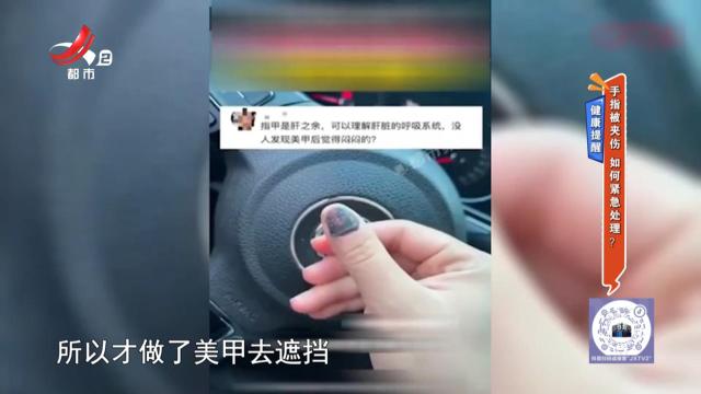 健康提醒——手指被夹伤 如何紧急处理？