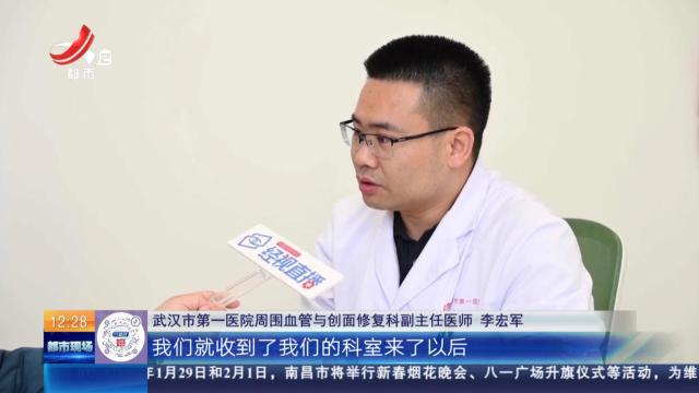 湖北武汉：男子学狗语驯养自家狗 刚一开口就被咬