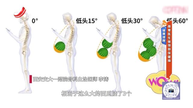 健康提醒——跟着医生做颈部保健操