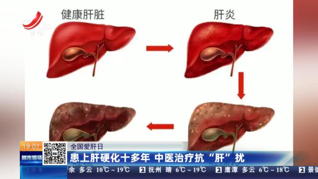 【全国爱肝日】患上肝硬化十多年 中医治疗抗”肝“扰