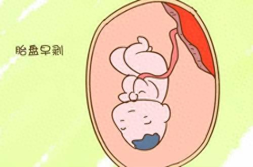 奋力抢救4个多小时后，母女平安！