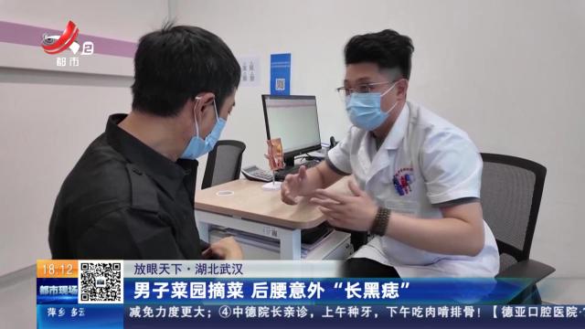 【放眼天下】湖北武汉：男子菜园摘菜 后腰意外“长黑痣”