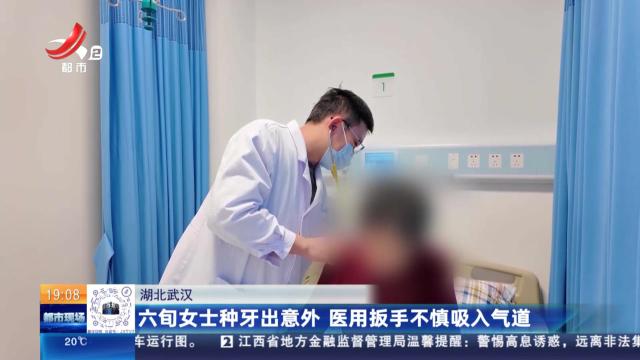 湖北武汉：六旬女士种牙出意外 医用扳手不慎吸入气道