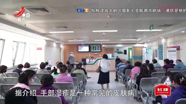 健康提醒——手部湿疹如何防治？