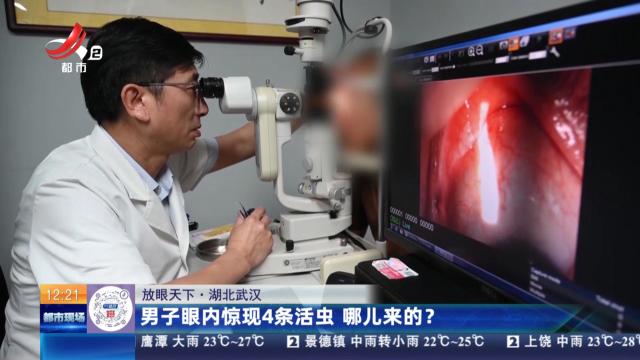 【放眼天下】湖北武汉：男子眼内惊现4条活虫 哪儿来的？