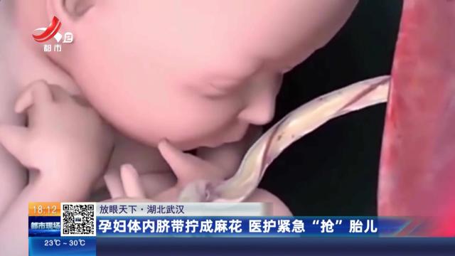 【放眼天下】湖北武汉：孕妇体内脐带拧成麻花 医护紧急“抢”胎儿