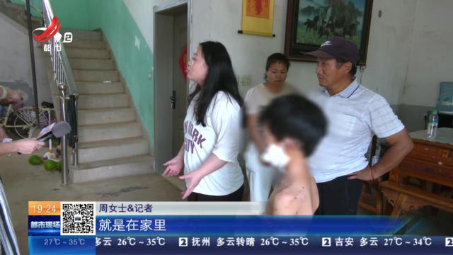【民法典在身边】南昌新建：孩童串门被狗咬伤 狗主认为无需担责