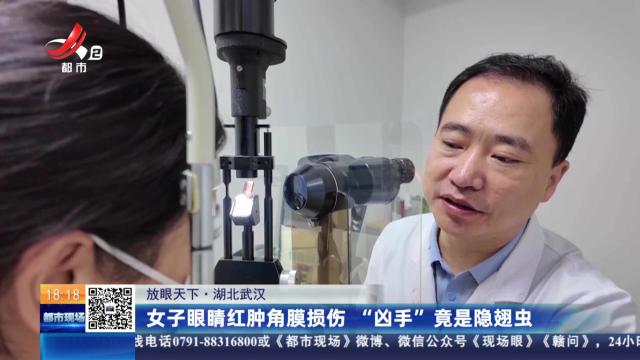 【放眼天下】湖北武汉：女子眼睛红肿角膜损伤 “凶手”竟是隐翅虫