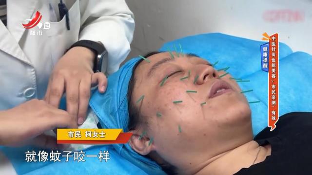 健康提醒——中医针灸也能美容？市民亲测：有效